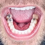 Bigoleteeth14