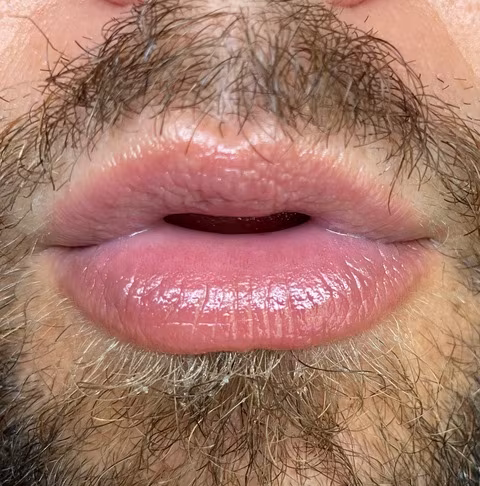 Bigoleteeth14